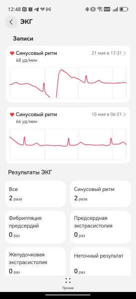 ЕКГ на Huawei Watch Fit 4 Pro Как выглядит ЭКГ на Huawei Watch Fit 4 Pro