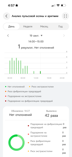 Огляд Huawei Watch GT 6 Обзор Huawei Watch GT 6