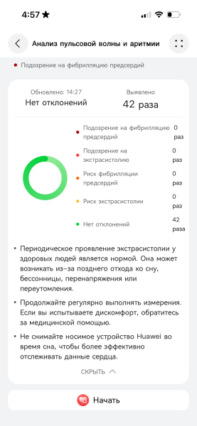 Огляд Huawei Watch GT 6 Обзор Huawei Watch GT 6