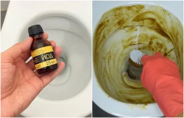 Йод прибирає жовті плями та наліт Йод убирает желтые пятна и налет