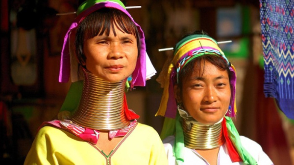 Один из ярких примеров трансформации тела ради красоты. /Фото: neptune-edu.com