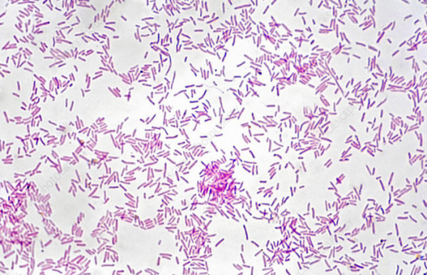 Знакомьтесь с мелкими пакостниками. /Фото: sciencephoto.com. 