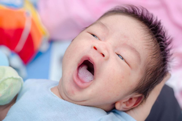 Сода не помогает при кандедозе.  Фото: static.tildacdn.com.