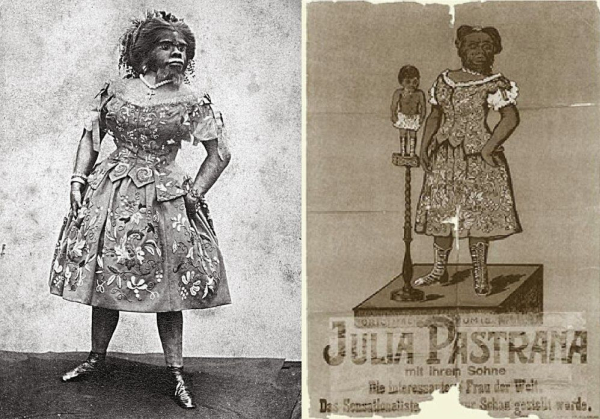 Юлия Пастарна по прозвищу женщина-горилла.  Фото: 2.bp.blogspot.com.