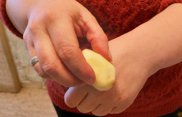 Сырой картофель избавит вас от пятен на руках.