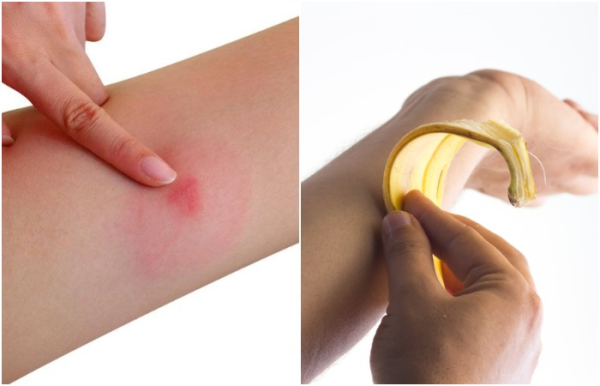 Кожура снимет покраснение и воспаление